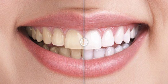 Before & After Images Comparison WordPress Plugin